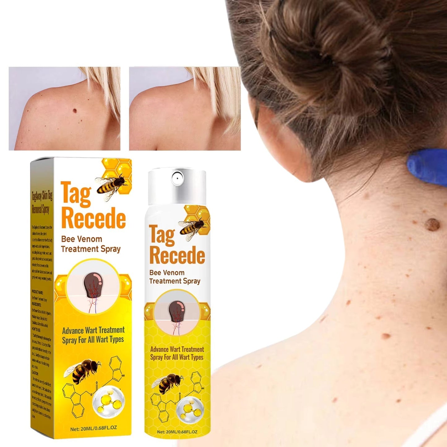Tag Recede Bee Venom Repair Spray – Advanced Skin Tag & Wart Care | Natural Bee Venom Skin Repair Spray for Smooth Healthy Skin